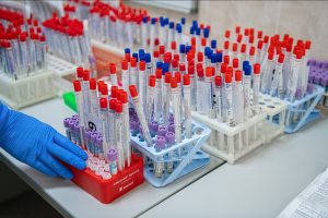 Сдать анализ на антитела к коронавирусу можно в поликлиниках Подмосковья